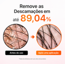 Sérum Capilar Lilyeve Growturn Crescimento Antiqueda Com Aplicador 38 Pontas 100ml
