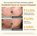 Medicube Sérum Ácido Kójico, Cúrcuma e Niacinamida 30ml
